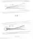 Fig. 09 - Selective Stiffening Catheter