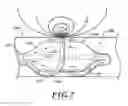 Fig. 08 - DELIVERY DEVICES WITH COOLABLE ENERGY EMITTING ASSEMBLIES