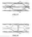 Fig. 14 - DELIVERY DEVICES WITH COOLABLE ENERGY EMITTING ASSEMBLIES