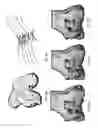 Fig. 07 - Configuring a surgical tool