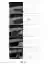 Fig. 08 - METHOD AND APPARATUS FOR SEGMENTATION OF BLOOD VESSELS