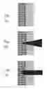 Fig. 03 - Simulated method and system for navigating surgical instrument based on tomography