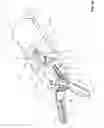 Fig. 08 - Surgical system and methods for mimicked motion
