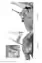 Fig. 33 - Universal instrument guide for robotic surgical systems, surgical instrument systems, and methods of their use