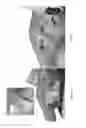 Fig. 35 - Universal instrument guide for robotic surgical systems, surgical instrument systems, and methods of their use
