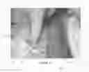 Fig. 21 - Surgical implant for marking soft tissue