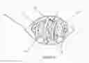 Fig. 22 - Surgical implant for marking soft tissue