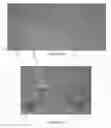 Fig. 25 - Surgical implant for marking soft tissue