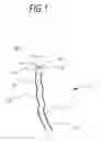 Fig. 02 - DENTAL IMPLANTATION DEVICE