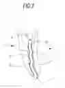 Fig. 03 - DENTAL IMPLANTATION DEVICE