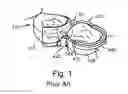 Fig. 02 - Dental separator device