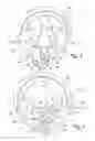 Fig. 03 - Dental separator device