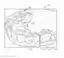Fig. 01 - Mold with weakened areas