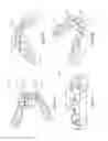 Fig. 11 - Mold with weakened areas