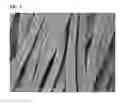 Fig. 04 - GINGIVAL RETRACTION CORD USING MICROFIBER