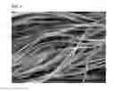 Fig. 05 - GINGIVAL RETRACTION CORD USING MICROFIBER