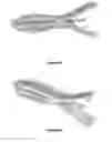 Fig. 04 - Drug delivery device