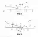 Fig. 03 - Sacrocolpopexy support