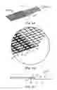 Fig. 04 - Sacrocolpopexy support