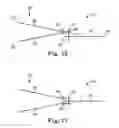 Fig. 12 - Sacrocolpopexy support