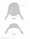 Fig. 15 - System and method for treating prolapse and incontinence