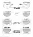 Fig. 01 - Method of manufacturing breast implants with integrated transponders