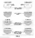 Fig. 03 - Method of manufacturing breast implants with integrated transponders