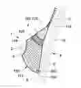 Fig. 01 - Prosthesis for supporting a breast structure