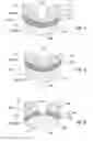 Fig. 03 - Prosthesis for supporting a breast structure