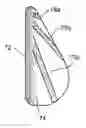 Fig. 01 - Soft filled prosthesis shell with discrete fixation surfaces