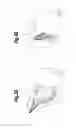 Fig. 03 - Soft filled prosthesis shell with discrete fixation surfaces