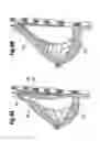 Fig. 04 - Soft filled prosthesis shell with discrete fixation surfaces