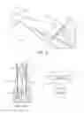 Fig. 10 - Intraocular lens injector