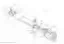Fig. 01 - Intraocular lens injector