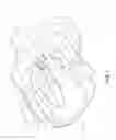 Fig. 06 - Intraocular lens injector