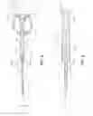 Fig. 07 - Intraocular lens injector