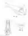 Fig. 10 - Intraocular lens injector