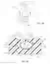 Fig. 21 - Intraocular lens injector