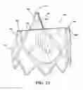 Fig. 25 - DURABLE MULTI-LAYER HIGH STRENGTH POLYMER COMPOSITE SUITABLE FOR IMPLANT AND ARTICLES PRODUCED THEREFROM