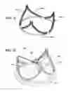 Fig. 31 - DURABLE MULTI-LAYER HIGH STRENGTH POLYMER COMPOSITE SUITABLE FOR IMPLANT AND ARTICLES PRODUCED THEREFROM