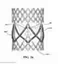 Fig. 35 - DURABLE MULTI-LAYER HIGH STRENGTH POLYMER COMPOSITE SUITABLE FOR IMPLANT AND ARTICLES PRODUCED THEREFROM