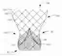 Fig. 01 - Bowed runners and corresponding valve assemblies for paravalvular leak protection