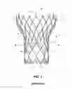 Fig. 02 - Bowed runners and corresponding valve assemblies for paravalvular leak protection