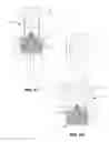 Fig. 07 - Bowed runners and corresponding valve assemblies for paravalvular leak protection