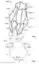 Fig. 03 - Prosthetic aortic heart valves