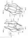 Fig. 04 - Prosthetic aortic heart valves