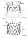 Fig. 06 - Prosthetic aortic heart valves