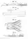 Fig. 02 - System to assist in the release of a collapsible stent from a delivery device