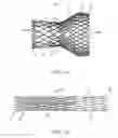 Fig. 02 - Systems, devices and methods for transcatheter valve delivery