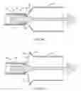 Fig. 07 - Systems, devices and methods for transcatheter valve delivery